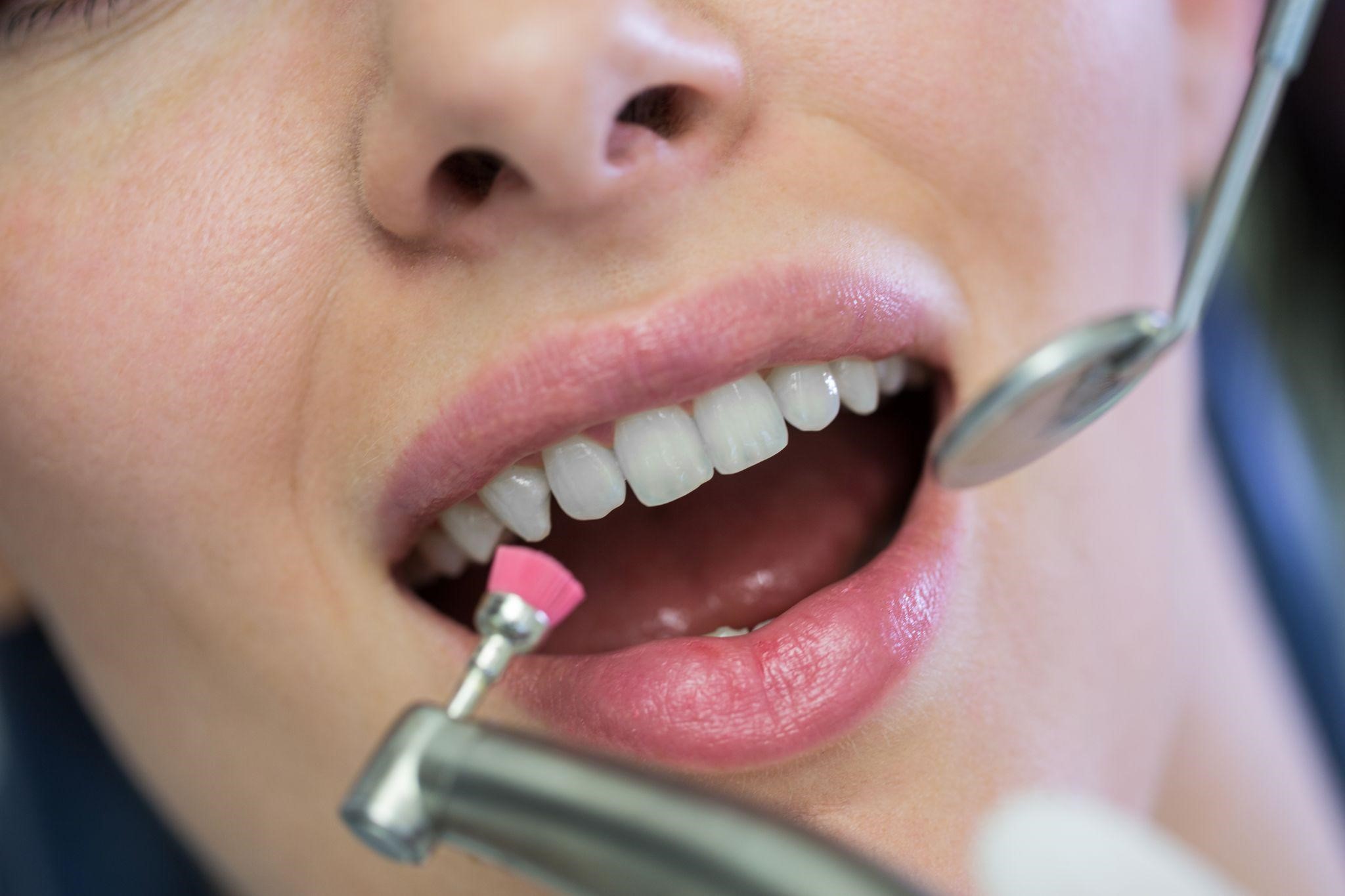 From Consultation to Completion: What to Expect During Your Implant Restoration at Williamstown Road Dental Surgery